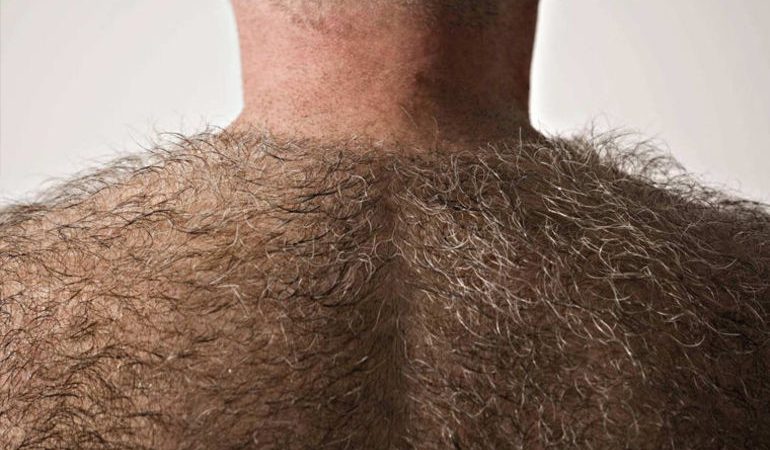 Багато волосся на своєму тілі по соннику: трактування сновидіння для жінок і чоловіків, ймовірність його втілення