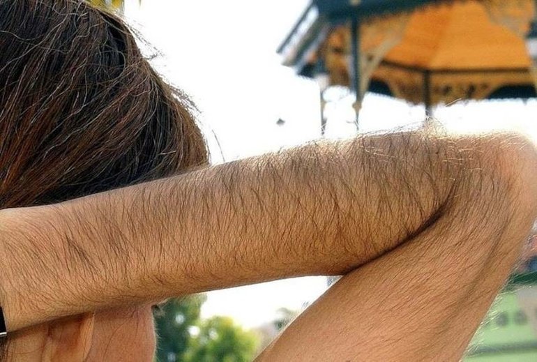Багато волосся на своєму тілі по соннику: трактування сновидіння для жінок і чоловіків, ймовірність його втілення