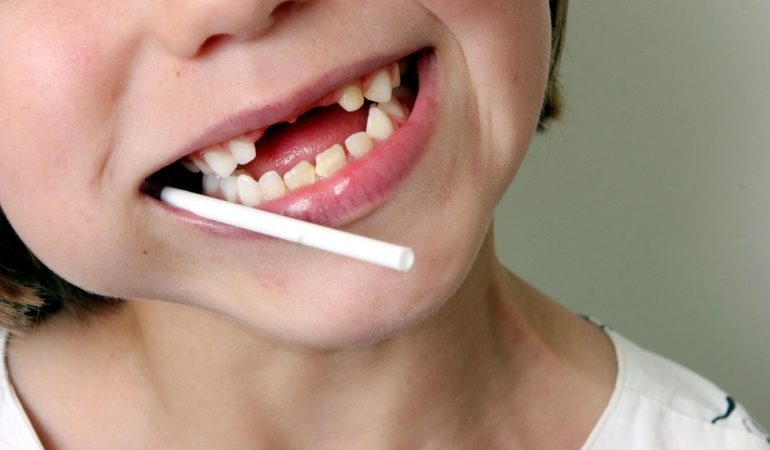 До чого бачити зуб уві сні приснилося багато зруйнованих різців з кров’ю і без, тлумачення різних сонників