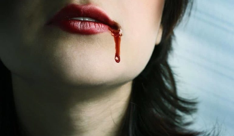 До чого може приснитися кров з рота: відповіді з найпопулярніших сонників