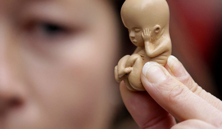 До чого сниться аборт: приснилося вагітній жінці на великому терміні, чоловікові, думка Ванги і Фрейда