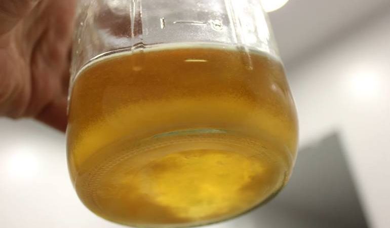 До чого сниться своя або чужа сеча: особливості випорожнень за сонником, виділення людини або тварин