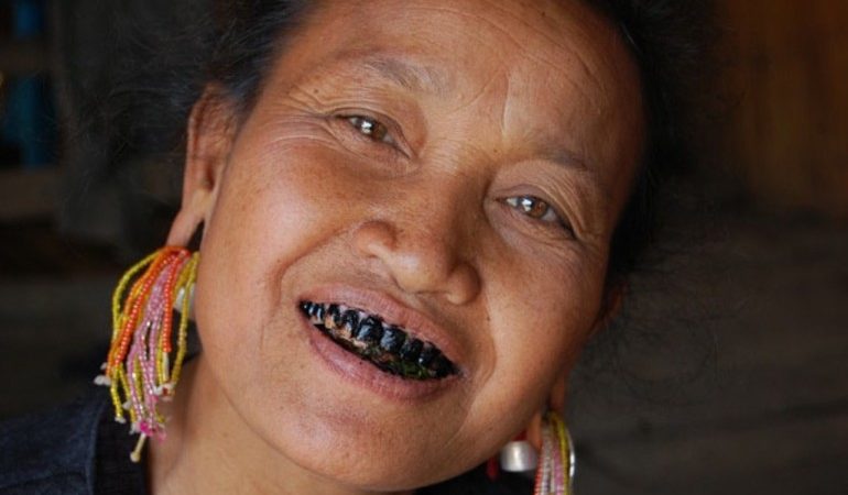 До чого сняться чорні зуби: бачити, як випали або почорнілі зуби у себе в роті, значення в різних сонниках