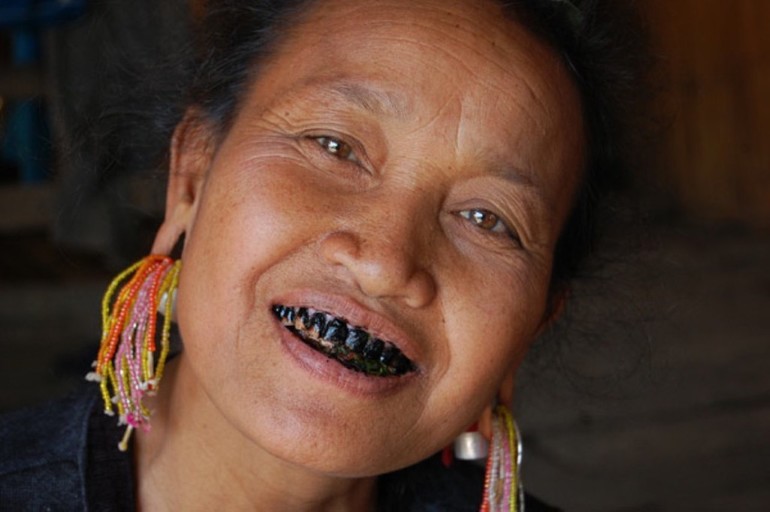 До чого сняться чорні зуби: бачити випали або почорнілі у себе в роті, значення в різних сонники