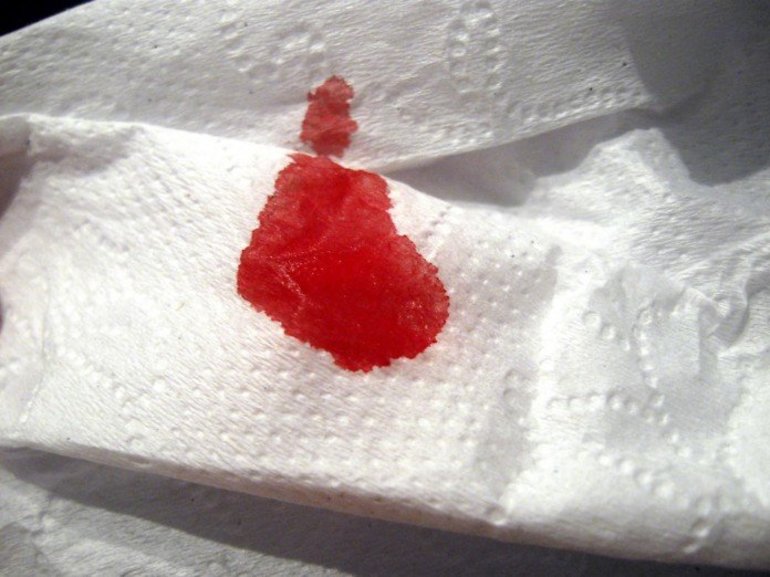 До чого сняться місячні: бачити в сні менструальну кров для жінки, тлумачення рясного кровотечі