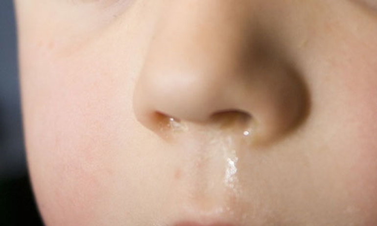 До чого сняться соплі: зелені і густі, у дитини і стороннього, высмаркиваться і чистити ніс