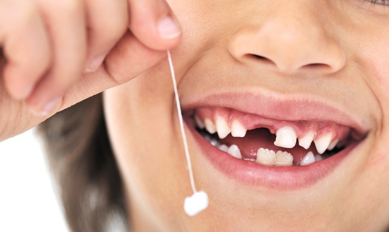 До чого сняться вибиті зуби: значення зубів з кров’ю чи без у популярних сонники