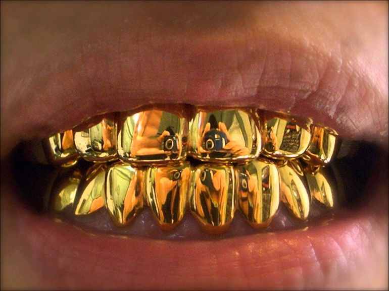До чого сняться золоті зуби: тлумачення з відомим сонникам