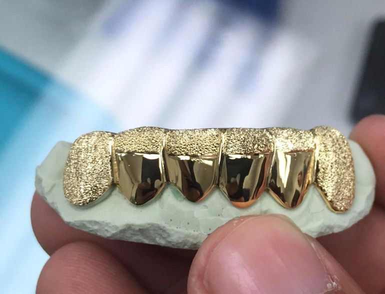 До чого сняться золоті зуби: тлумачення з відомим сонникам
