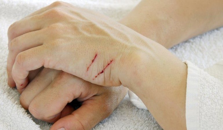 Кішка подряпала уві сні: до чого сниться царапающийся кіт або кошеня по соннику