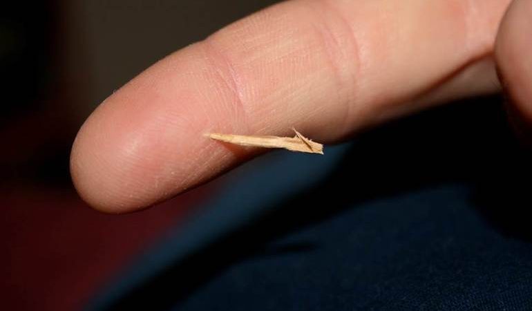 Сонник до чого сниться жало, що віщує подібне сновидіння спящему