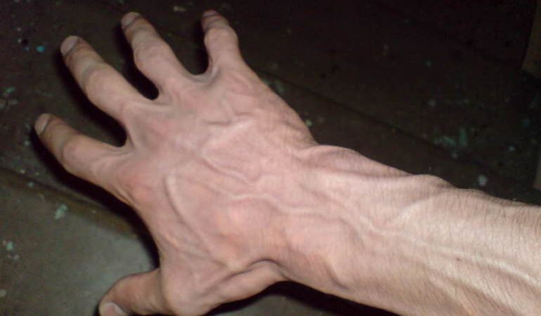 Сонник вени: трактування сновидіння в популярних сонники