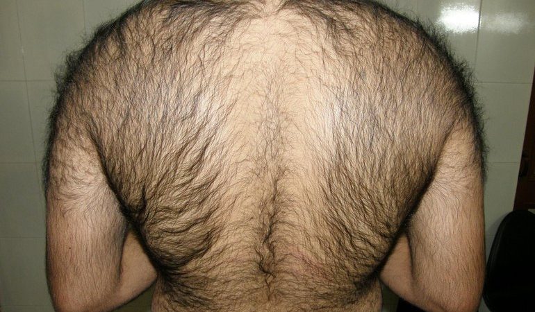 Сонник: волохата спина жінки або чоловіки, різні трактування