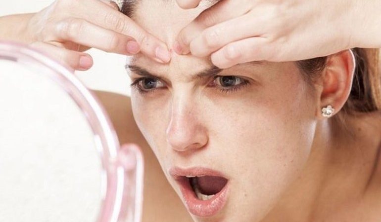 Тиснути прищі уві сні: трактування по сонникам, що означає видаляти гнійні нарости і великі вугрі на обличчі і тілі